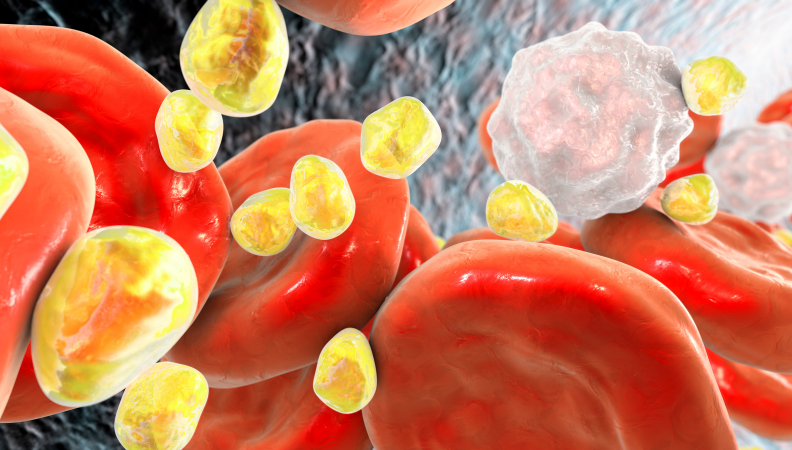 Tratamiento de colesterol y triglicéridos en Cancún | Medicina Interna Cancún
